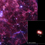 Chandra Discovers Cosmic Cannonball