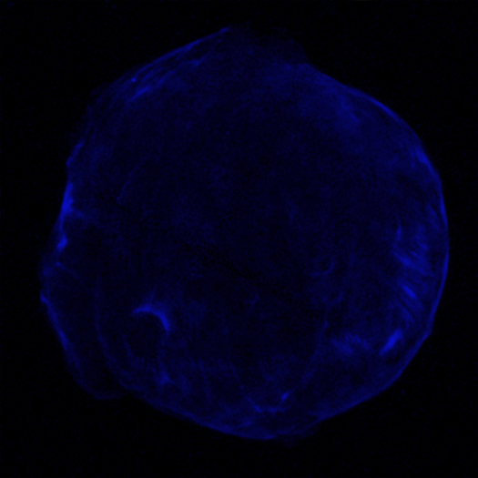 Tycho's Supernova Remnant