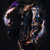 X-ray image